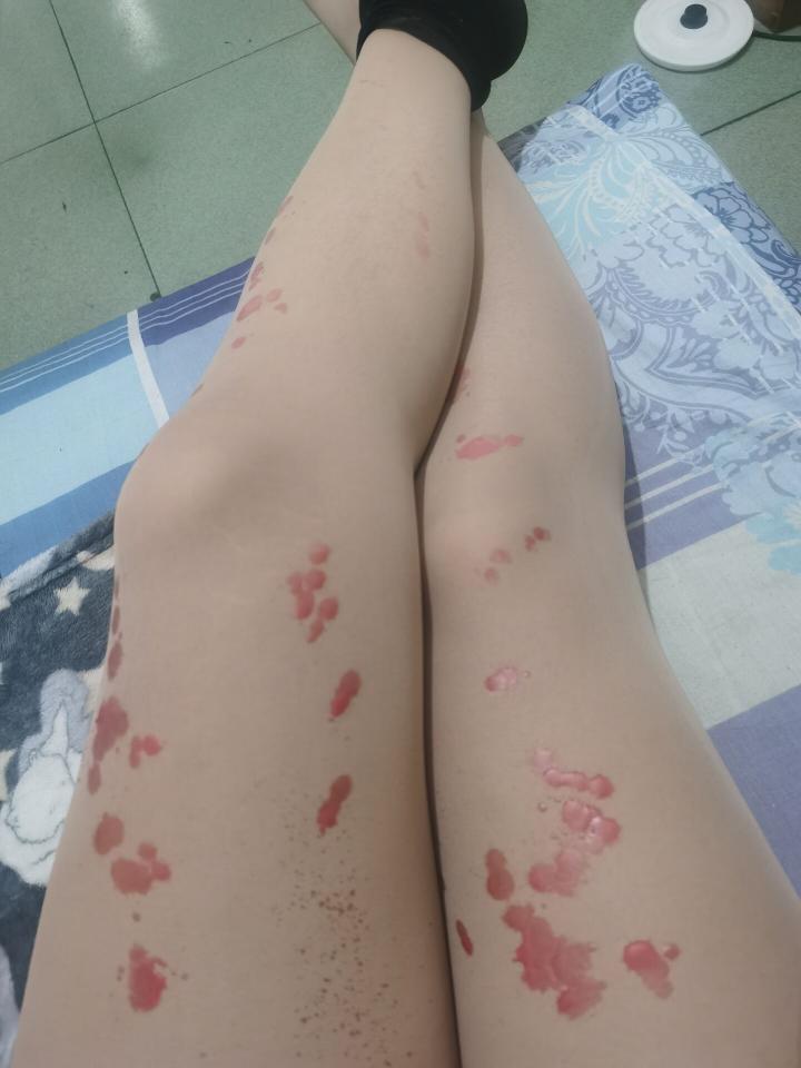 第一次自己玩滴蜡，感觉好刺激 - 因为比较怕，所以穿了丝袜，希望大家不要介意